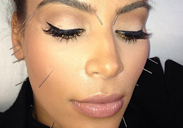 Kardashian z igłami w twarzy! (FOTO)